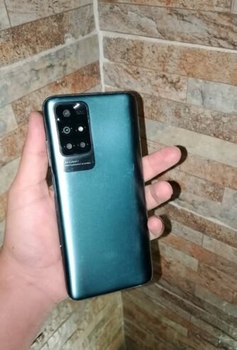 ؤشاومي نوت 11مستعمل اخو الوكاله REDMI NOTE 11